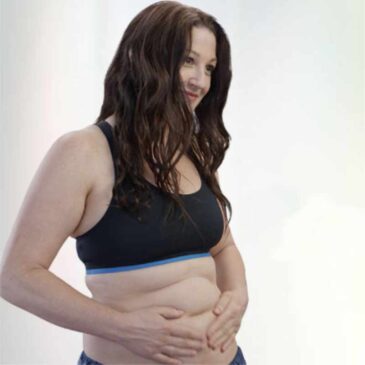 Coolsculpting®