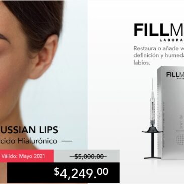 Russian Lips – Promoción Mayo 2021