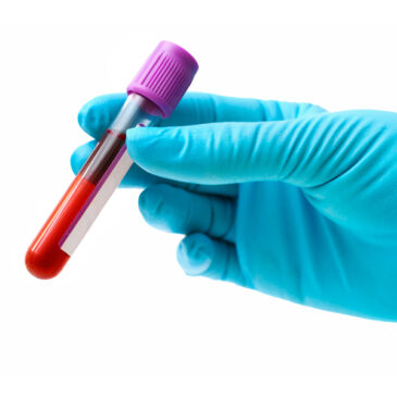 PRP, Plasma Rico en Plaquetas